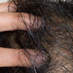 抜け毛・薄毛の悩みを一刀両断。