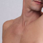 脱毛サロンの脱毛効果は？