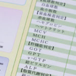 AGAの診断キットとは?