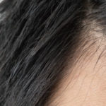 AGAの効果は産毛から?