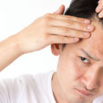 AGAの治療効果はなし?