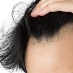 生え際が後退している髪の毛を触る男性