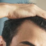 AGA治療で起こる初期脱毛とは?