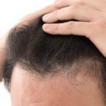 生え際が後退した髪の毛を触る男性