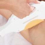 ダイオードレーザーの脱毛効果は？