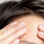 おでこ脱毛のおすすめ人気ランキング