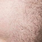 【メンズ】ギャランドゥー脱毛おすすめ人気ランキング