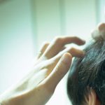 自毛植毛の失敗例は?