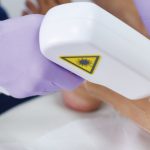 ソプラノの脱毛効果は？