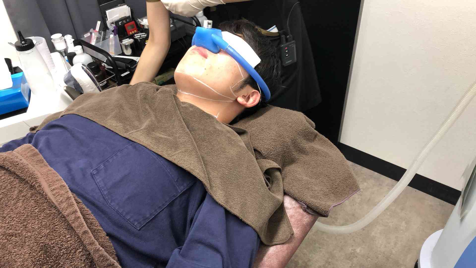 ゴリラクリニックの髭脱毛 悪い口コミ 評判は本当 効果なし 予約取れない の実態を調査 Moteo