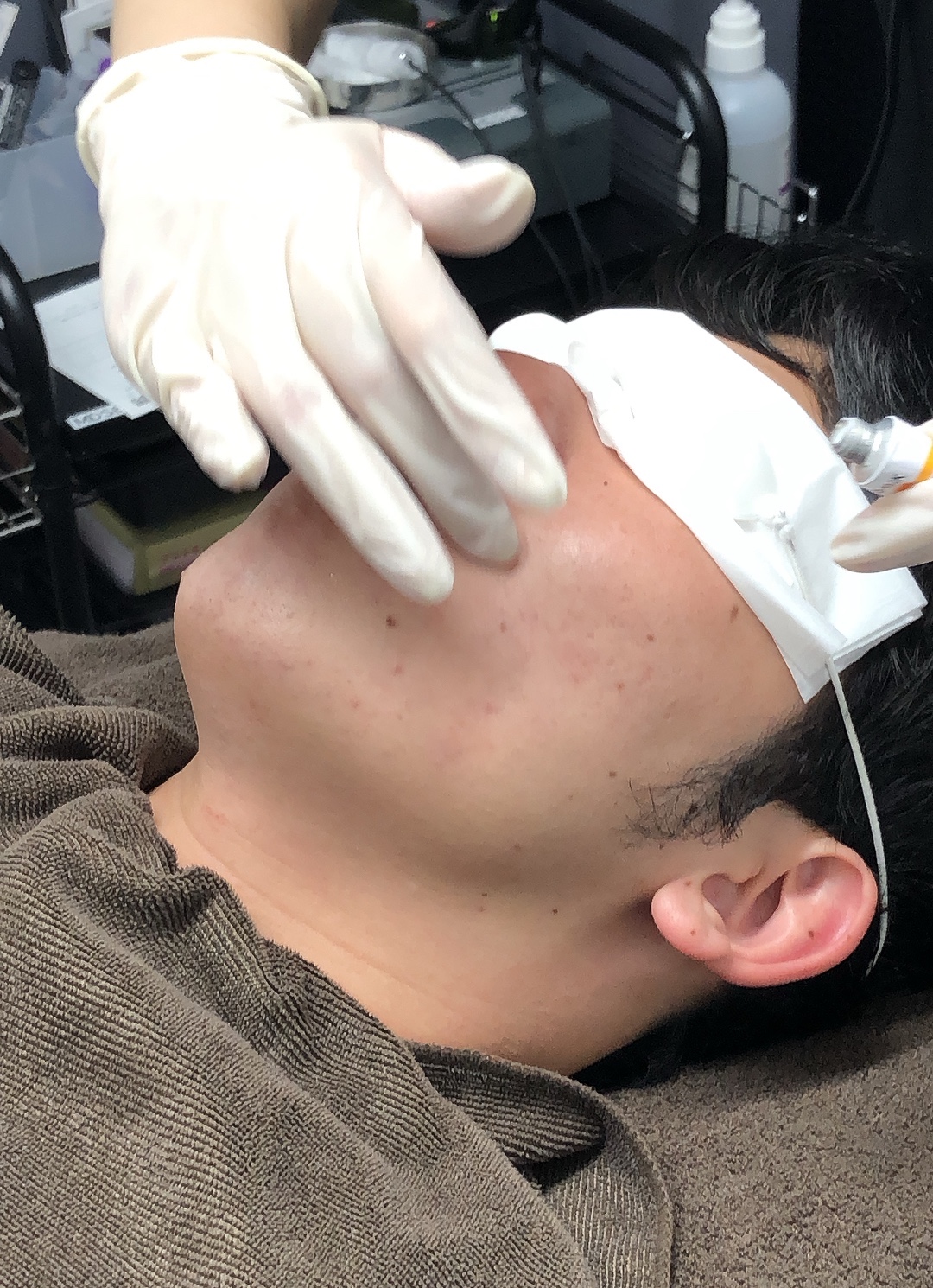 ゴリラクリニックの髭脱毛 悪い口コミ 評判は本当 効果なし 予約取れない の実態を調査 Moteo