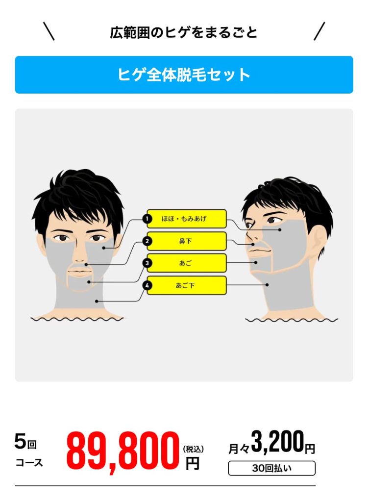 メンズリゼ ヒゲ全体脱毛セット